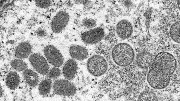 Hình ảnh hiển vi điện tử (EM) cho thấy các hạt virus đậu mùa khỉ thu được từ mẫu da người lâm sàng. Ảnh: Reuters