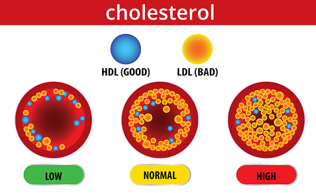 SOS H N 50 Ph N Trung Ni N Th A Cholesterol   Cholesterol Graphic Wmga 