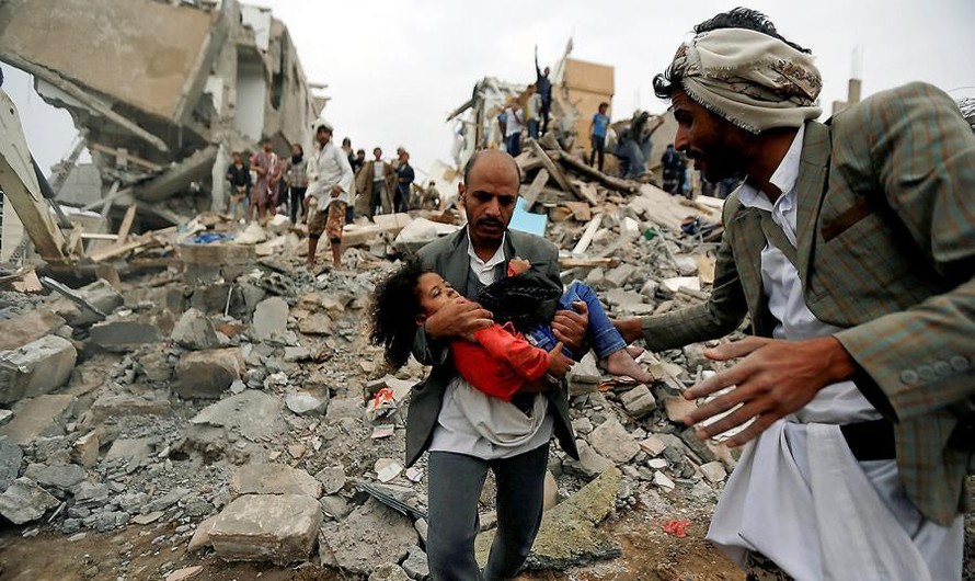 Chiến tranh gây ra cuộc khủng hoảng nhân đạo tồi tệ tại Yemen. Ảnh: AP