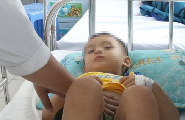 Bé trai 3 tuổi vỡ lá lách khi ngủ gật trên xe máy