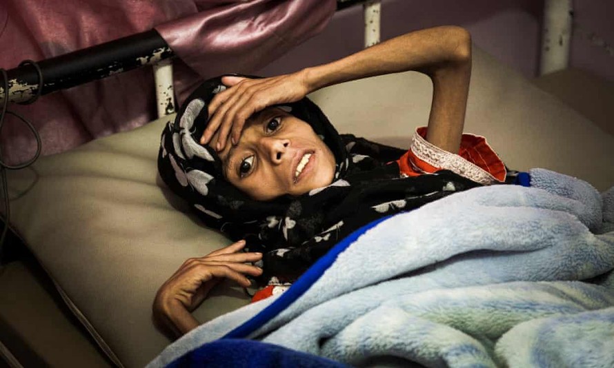 Sadia Ibrahim Mahmud, khi đó 11 tuổi, trên giường bệnh vào tháng 9 năm 2019. Cô bé đã qua đời không lâu sau đó. Ảnh: The Guardian