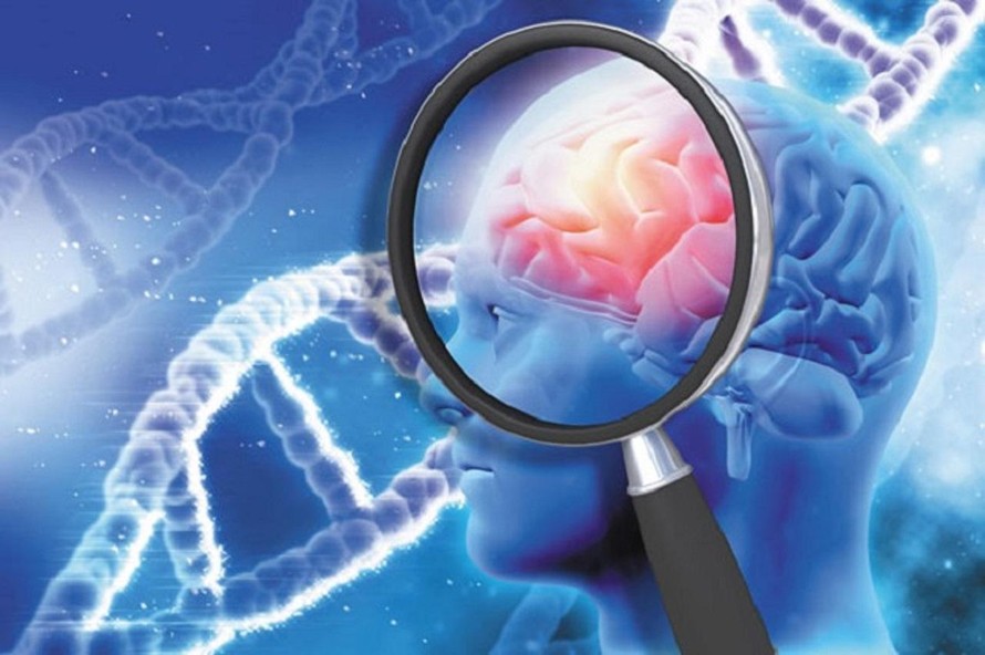 Nhật Bản phát hiện đặc điểm di truyền của người dễ mắc bệnh Alzheimer