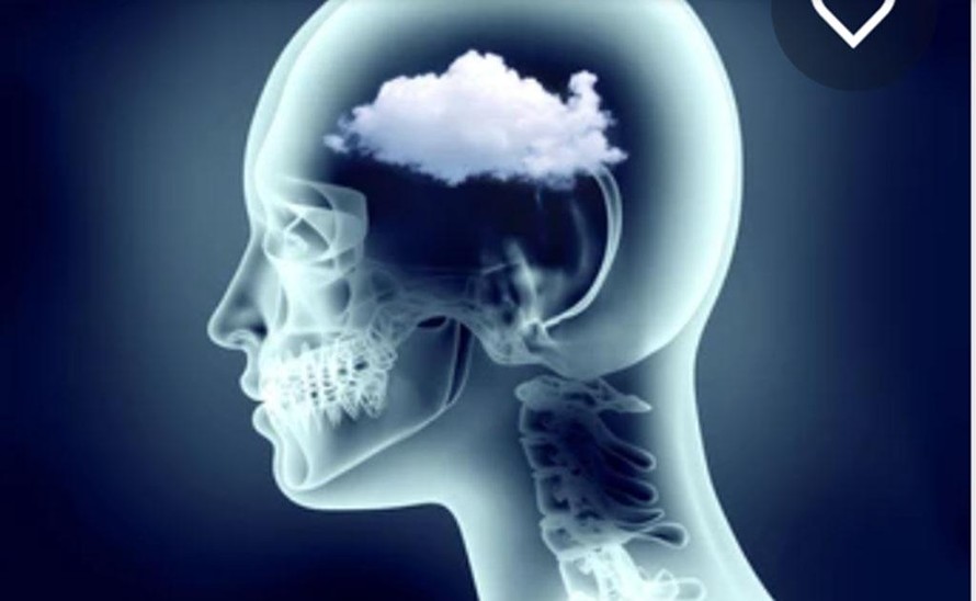 Australia tiến sát mục tiêu giải mã nguyên nhân gây 'sương mù não' hậu COVID-19