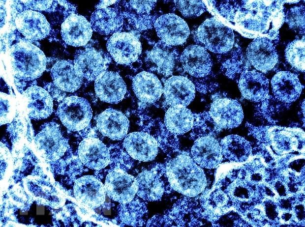 Hình ảnh từ kính hiển vi virus SARS-CoV-2 trong mẫu bệnh phẩm của bệnh nhân mắc COVID-19. (Ảnh: AFP)