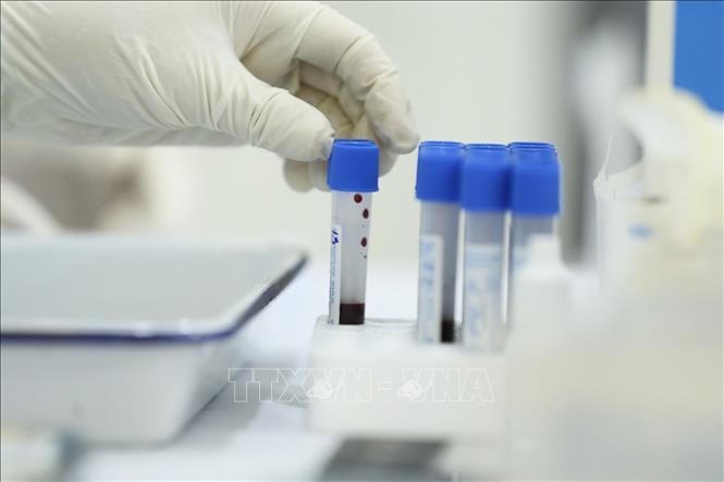 Bộ Y tế yêu cầu chấn chỉnh và xử lý vi phạm việc nhập khẩu, kinh doanh, mua sắm các loại test xét nghiệm nhanh và xét nghiệm RT-PCR. Ảnh minh họa: Minh Quyết/TTXVN